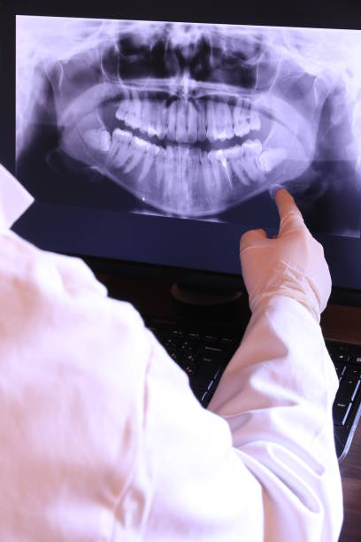 Best Emergency Tooth Extraction in Eureka, IL